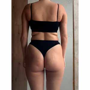 Віскі-сповивання у Василькові - Фото До - №1326