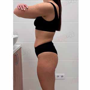 Віскі-сповивання у Василькові - Фото Після - №1335