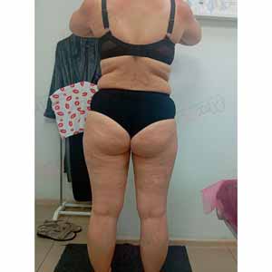 Віскі-сповивання у Василькові - Фото До - №1317