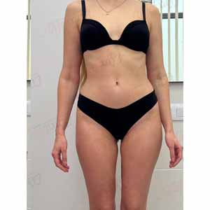 Віскі-сповивання у Василькові - Фото Після - №1333