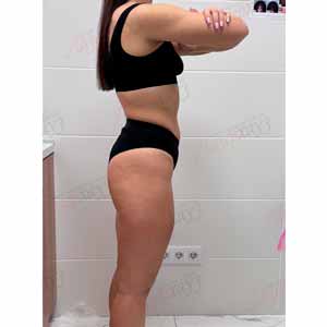 Віскі-сповивання у Василькові - Фото Після - №1336