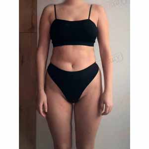 Віскі-сповивання у Василькові - Фото До - №1328