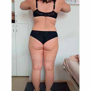 Віскі-сповивання у Василькові - Фото Після - №1317