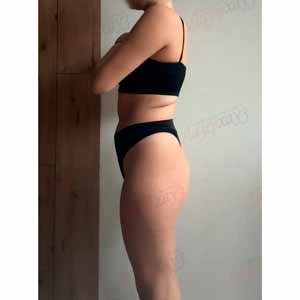 Віскі-сповивання у Василькові - Фото До - №1327