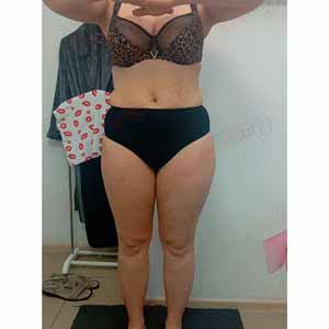 Віскі-сповивання у Василькові - Фото До - №1318