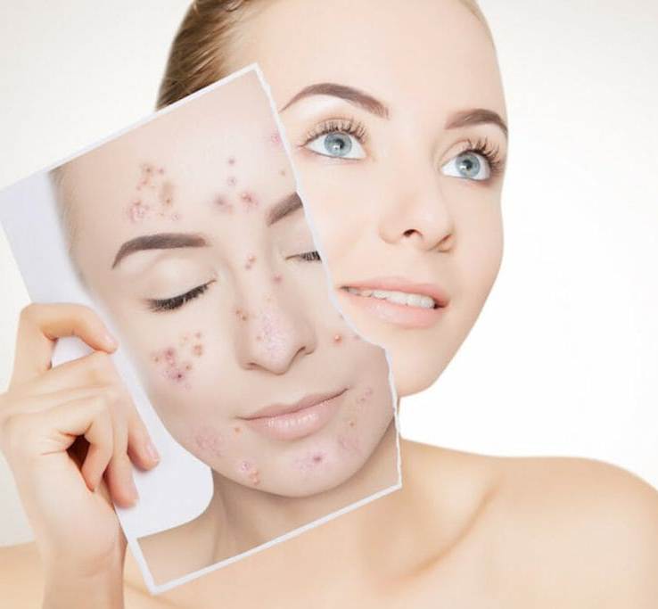 lecheniye-psoriaza.jpg Лечение псориаза в Киеве.jpg