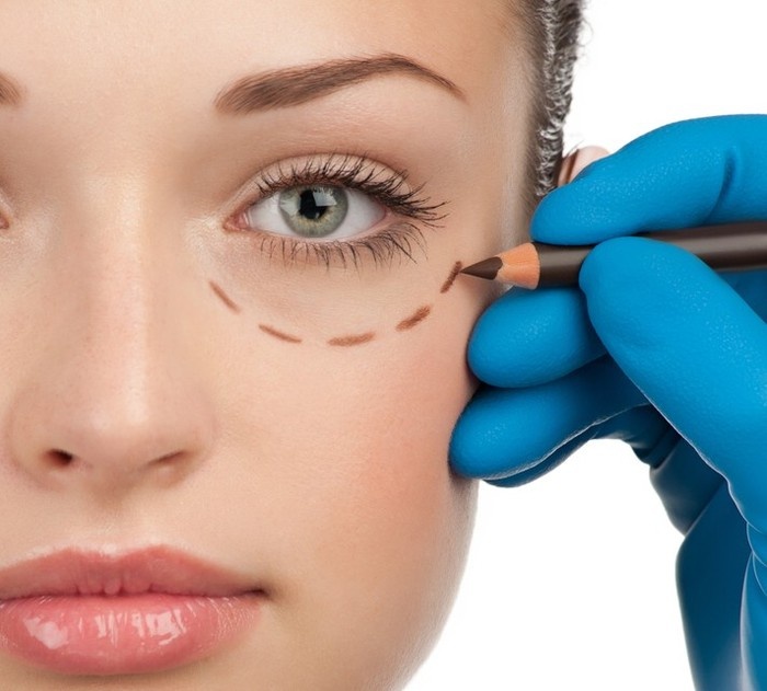 blefaroplastik.jpg Инъекционная блефаропластика